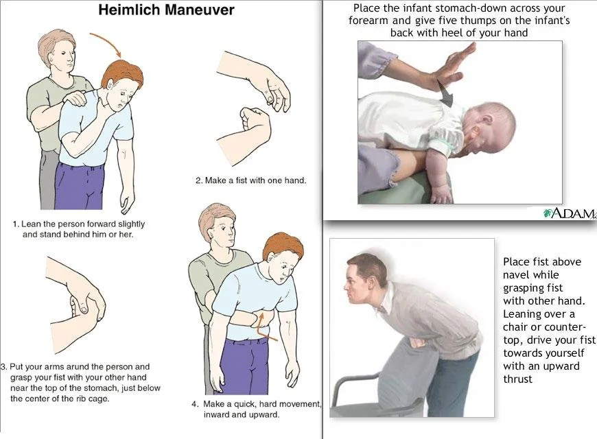 How to do Heimlich Maneuver?